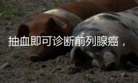 抽血即可诊断前列腺癌，拜登为何不测？
